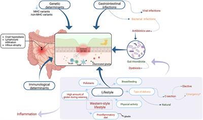 Why are western diet and western lifestyle pro-inflammatory risk factors of celiac disease?